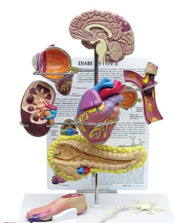 Modelo AnatÃ´mico de Efeitos da Diabete