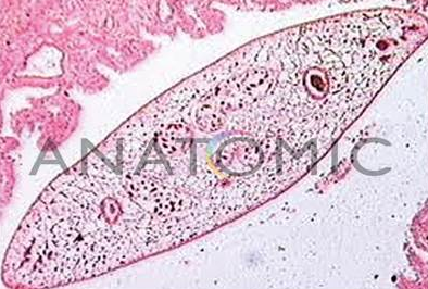 Conjunto de LÃ¢minas de Parasitologia