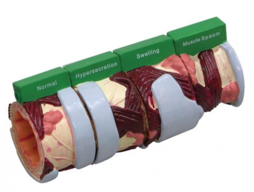 Modelo AnatÃ´mico de BrÃ´nquios