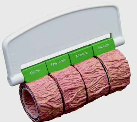Modelo AnatÃ´mico ArtÃ©rias e Veias